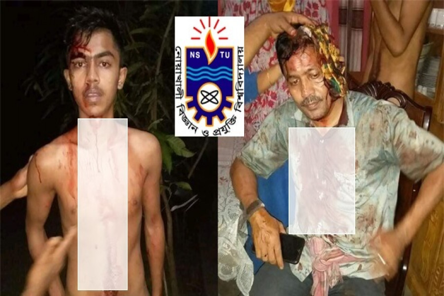 সন্ত্রাসী হামলায় নোবিপ্রবি শিক্ষার্থী সপরিবারে আহত