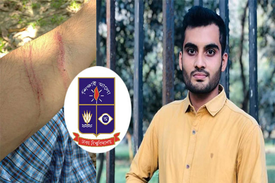 এই বর্বরতার কি কখনো শেষ হবে না- ঢাবি ছাত্রের আর্তনাদ