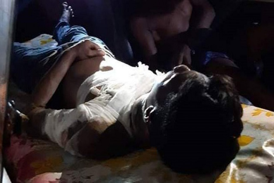 চেয়ারম্যানের বিরুদ্ধে চাল চুরির অভিযোগ করায় দুই যুবককে কুপিয়ে জখম