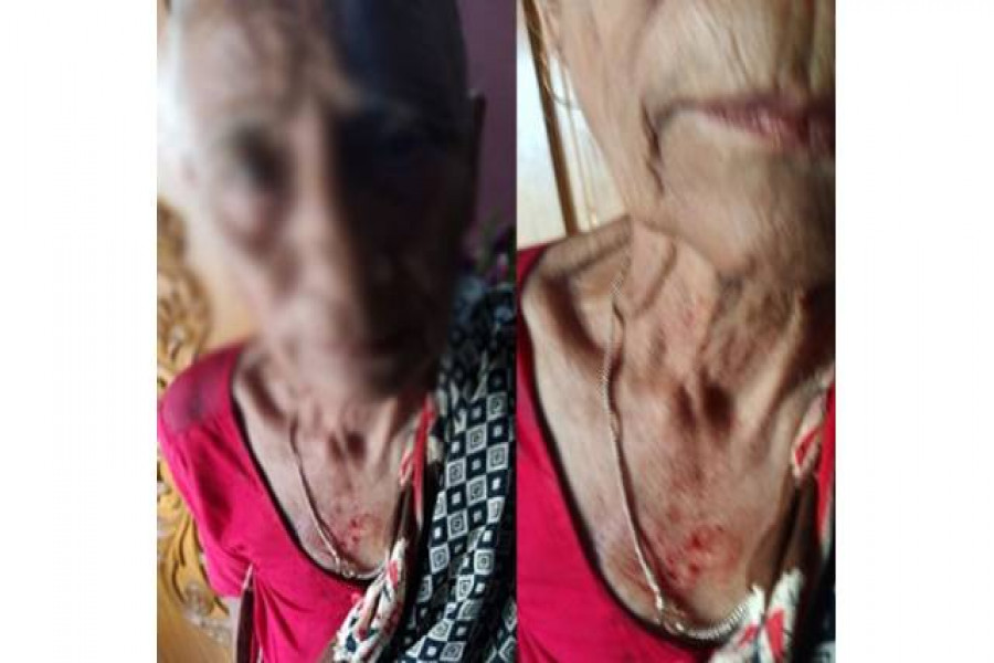 সম্পত্তি লিখে নিয়ে বৃদ্ধা মায়ের ভরণপোষণ বন্ধ করে দিল সন্তান