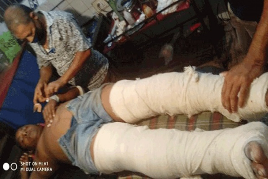 উপজেলা ছাত্রলীগ সভাপতিার পায়ের রগ কেটে দিল দুর্বৃত্তরা