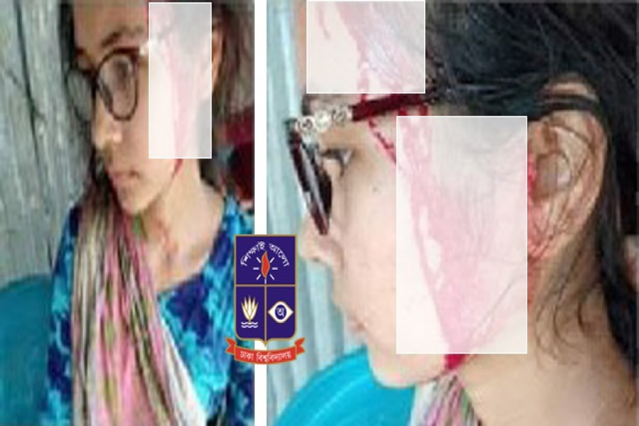 তুচ্ছ ঘটনায় ঢাবি ছাত্রীর মাথা ফাটালেন দুর্বৃত্তরা