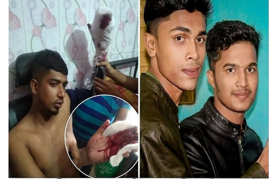 ২০ টাকার বিরোধে যুবলীগ নেতার হাতের আঙুল কেটে নিলো ছাত্রলীগ নেতারা 