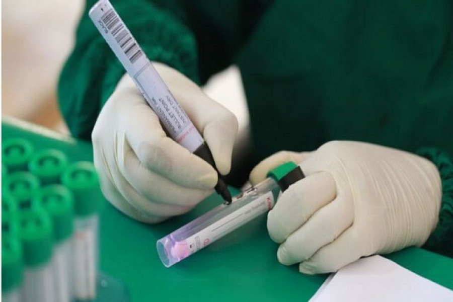 করোনার নমুনা পরীক্ষার নতুন প্রযুক্তি চালুর পরিকল্পনা করেছে ডব্লিউএইচও