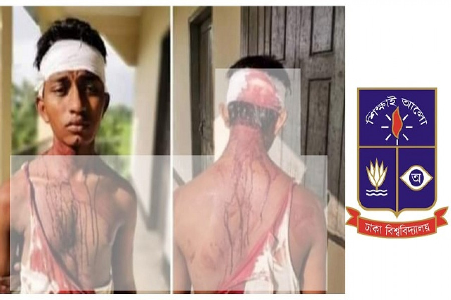 ঢাবি শিক্ষার্থী রাসেলের ওপর হামলা
