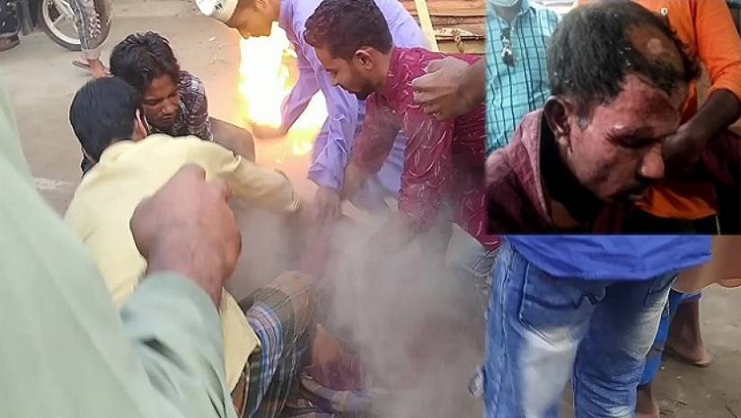 ম্যাক্রোঁর কুশপুত্তলিকায় আগুন দিতে গিয়ে...