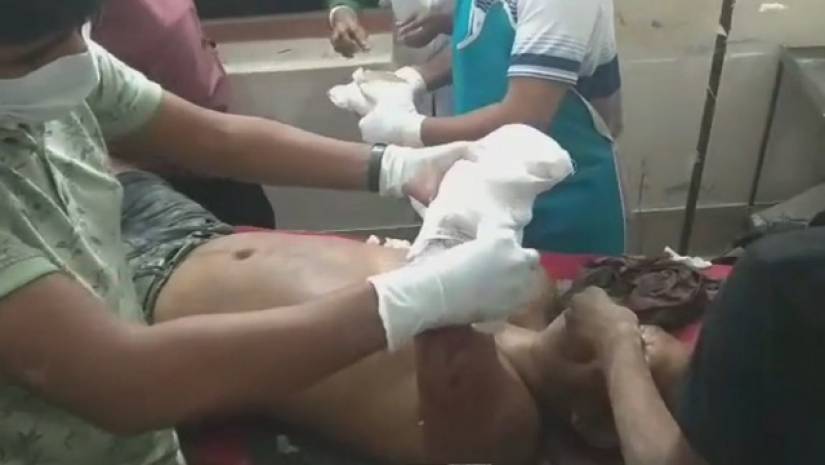 শ্রমিক লীগ নেতার হাত কেটে নিল সন্ত্রাসীরা