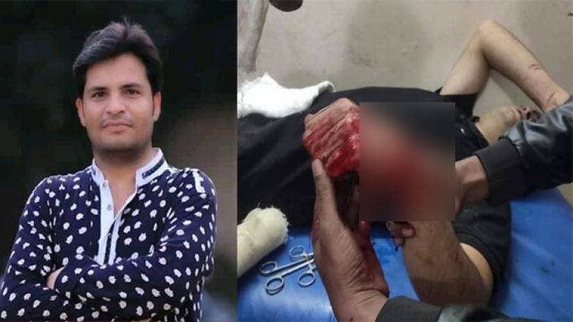 ছাত্রলীগ নেতার কবজি কেটে নেয়ার অভিযোগ বিএনপি নেতার বিরুদ্ধে