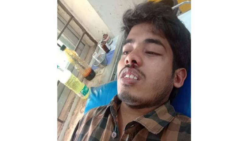 যুবলীগ নেতার নেতৃত্বে হামলায় ইত্তেফাকের ঢাবি প্রতিনিধি গুরুতর আহত