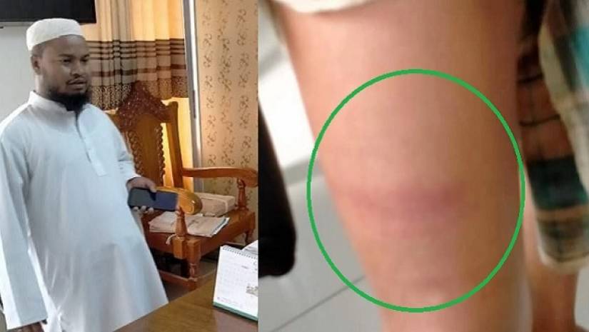 ছাত্রকে পিঠিয়ে জখম, মাদরাসা শিক্ষকের ৭ দিনের কারাদণ্ড