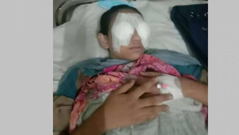 চাকরির আবেদন করায় গৃহবধূর চোখ উৎপাটনের চেষ্টা করলেন স্বামী 