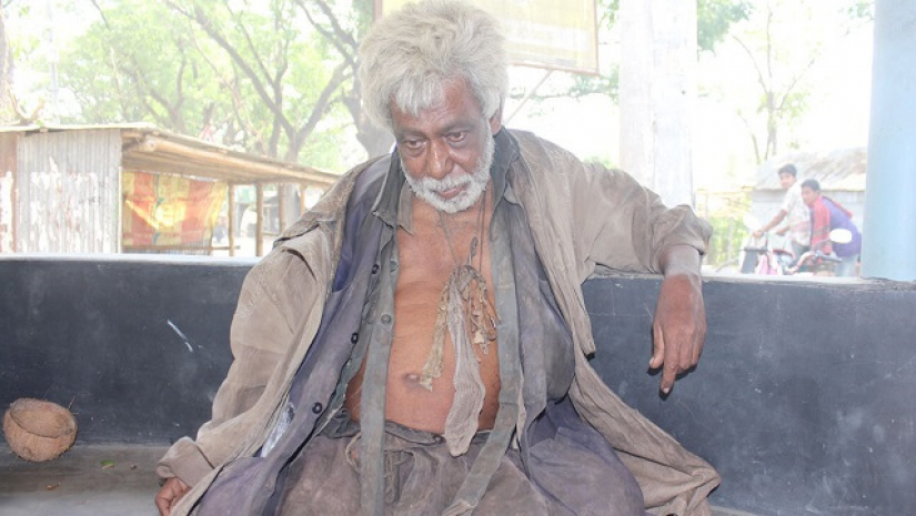 ঢাবির সাবেক ছাত্র ঘোরেন পথে, গায়ে ছেড়া পোশাক—ছিলেন গণিতে সেরা