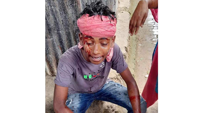 এক ছাত্রীর সঙ্গে দুই যুবকের প্রেম, সংঘর্ষে পুলিশসহ আহত ১৭