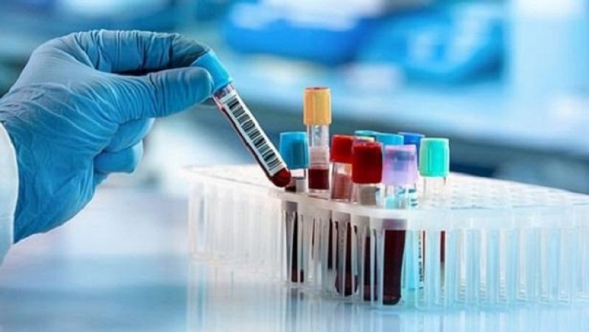 স্যালাইন দিয়ে করোনা পরীক্ষা, ফল মিলবে ৩ ঘণ্টায়