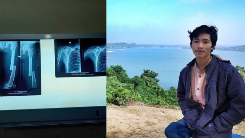 সড়ক দুর্ঘটনায় আহত রাবিপ্রবি ছাত্রের চিকিৎসায় এগিয়ে আসুন