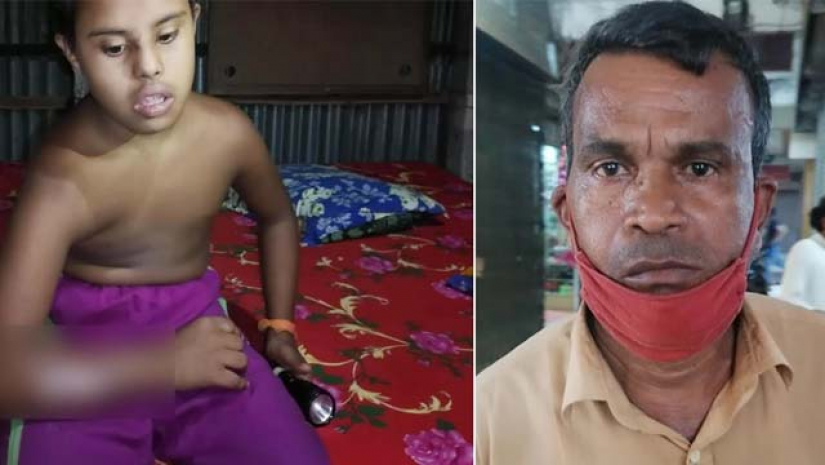 বুদ্ধি প্রতিবন্ধী শিশুর হাত ঝলসে দিলেন প্রধান শিক্ষক