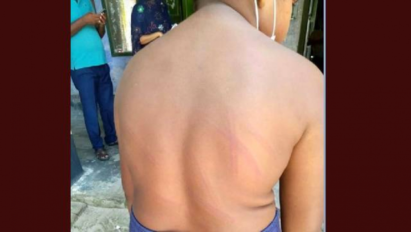 শিক্ষার্থীকে নির্দয়ভাবে পেটালেন প্রধান শিক্ষক