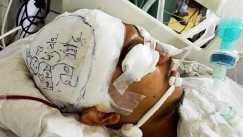 ধবধবে সাদা ব্যান্ডেজের ওপর লেখা, ‘হাড় নেই, চাপ দেবেন না।’ নিচে একটা বিপজ্জনক চিহ্নও এঁকে দেওয়া হয়েছে। চোখও সাদা ব্যান্ডেজে ঢেকে দেওয়া হয়েছে আকিবের