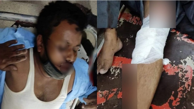 ভাড়া নিয়ে প্রতিবাদ করায় বাস থেকে ফেলে দেওয়া হলো শিক্ষককে