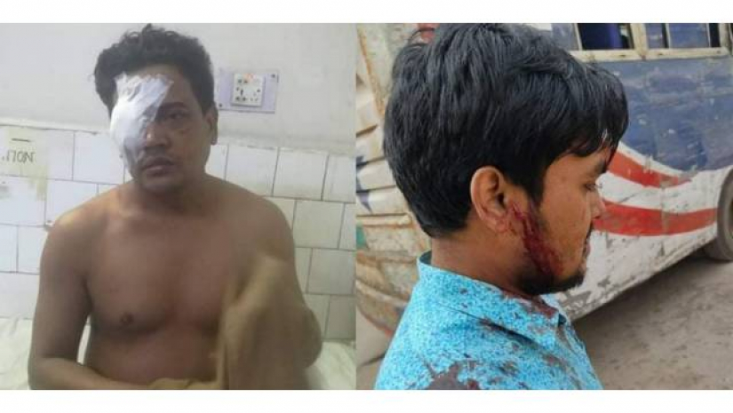 আহত দুইজন