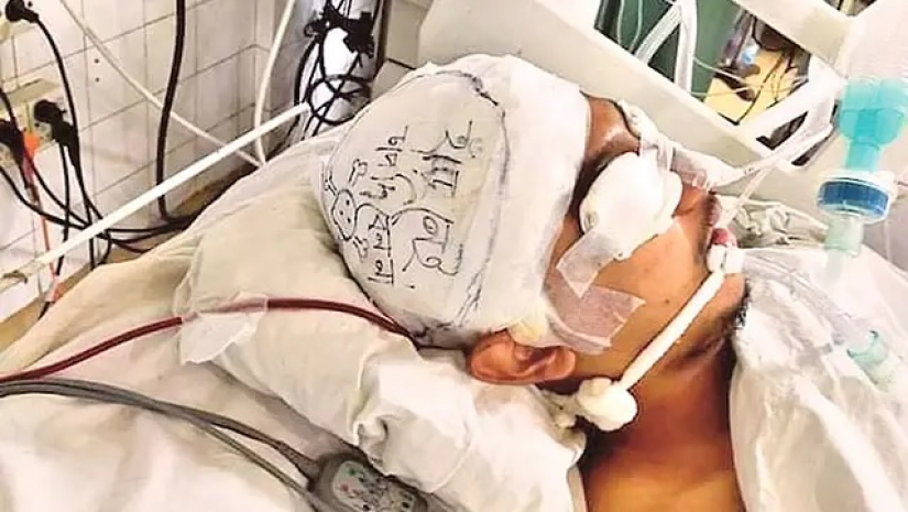 ছাত্রলীগের সংঘর্ষে আহত আকিব