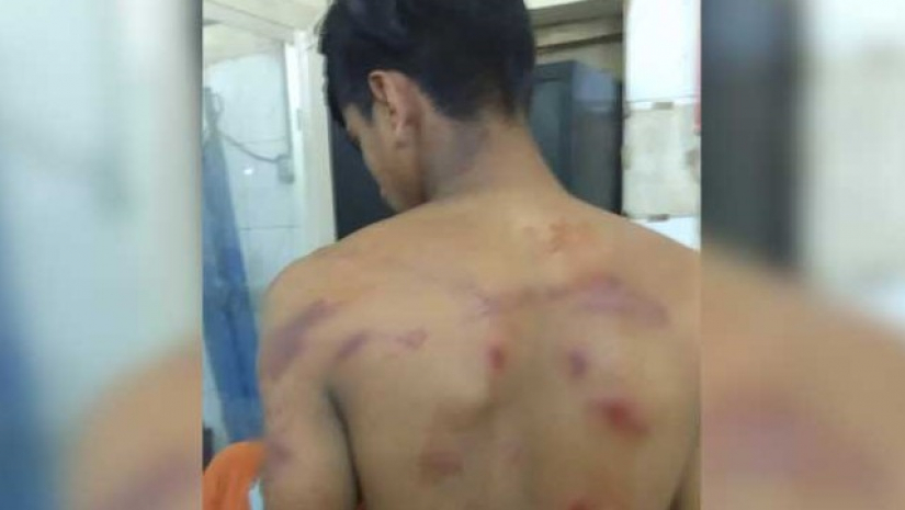 আহত শিক্ষার্থী সাইদুল