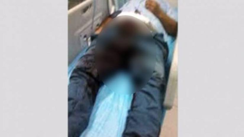 ধর্ষণ চেষ্টা করায় পুরুষাঙ্গ কেটে দিলেন বিধবা নারী