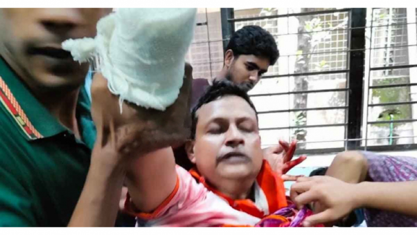 কবজি বিচ্ছিন্ন হওয়া তোফাজ্জেল হোসেন