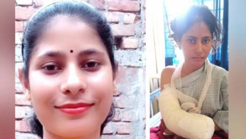 রেণুকে কাজ দেবে সরকার, পাবে চিকিৎসার খরচ-কৃত্রিম হাতও