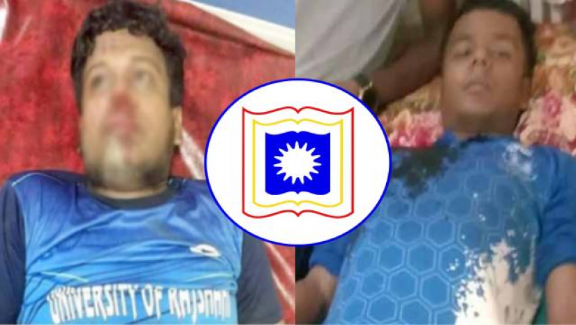আম পাড়তে গিয়ে দুর্ঘটনার কবলে পড়েছেন বিশ্ববিদ্যালয়টির একাধিক শিক্ষার্থী