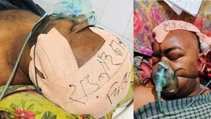 আরশাদুলের মাথার ব্যান্ডেজে চিকিৎসক লিখে রেখেছেন, ‘মাথায় হাড় নাই, চাপ দিবেন না'