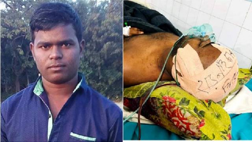 হাড়বিহীন মাথা নিয়ে মারা গেল ছাত্র, সাভারেই রয়ে গেল মগজ