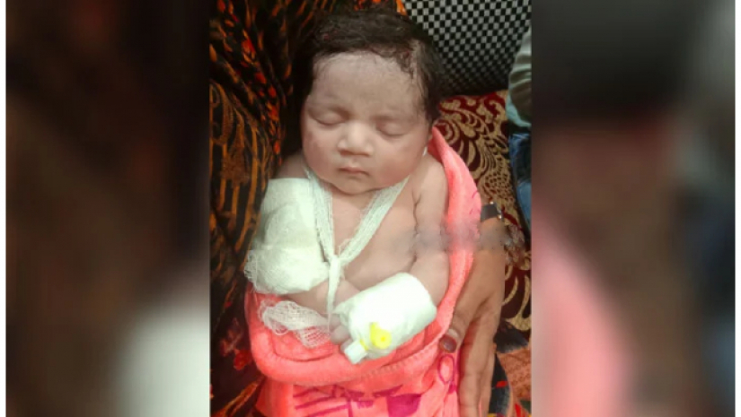 পেট ফেটে বেরিয়ে আসা শিশুর পক্ষে রিট করার পরামর্শ হাইকোর্টের