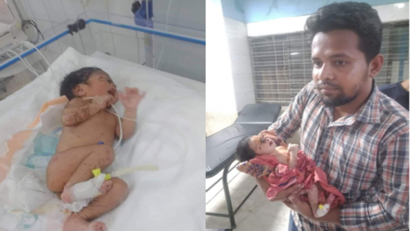  নবজাতক জীবিত উদ্ধার