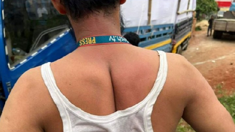 মারধরের শিকার সাংবাদিক 