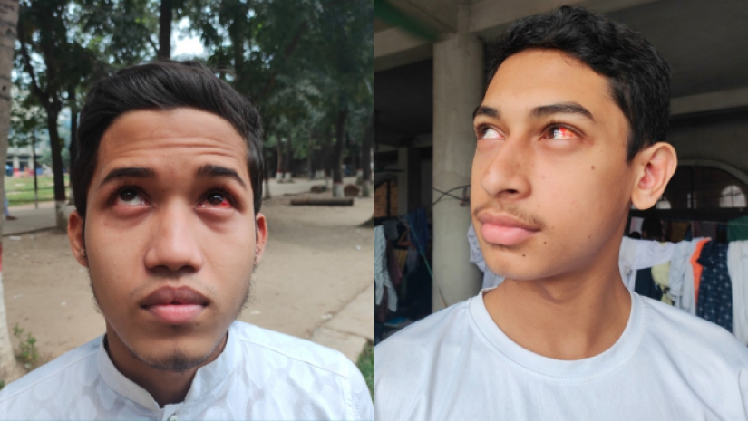 চোখ ওঠা রোগে আক্রান্ত তা’মীরুল মিল্লাতের শিক্ষার্থী