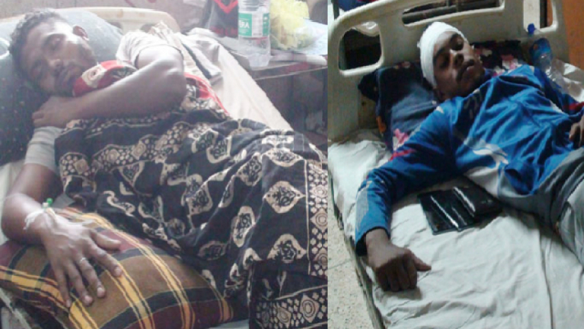 আর্জেন্টিনা সমর্থকদের পিটুনিতে হাসপাতালে ৫ ব্রাজিল সমর্থক