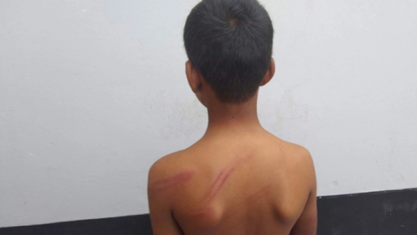 নির্যাতনের শিকার শিক্ষার্থী আজমী