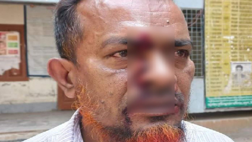 আহত প্রধান শিক্ষক 