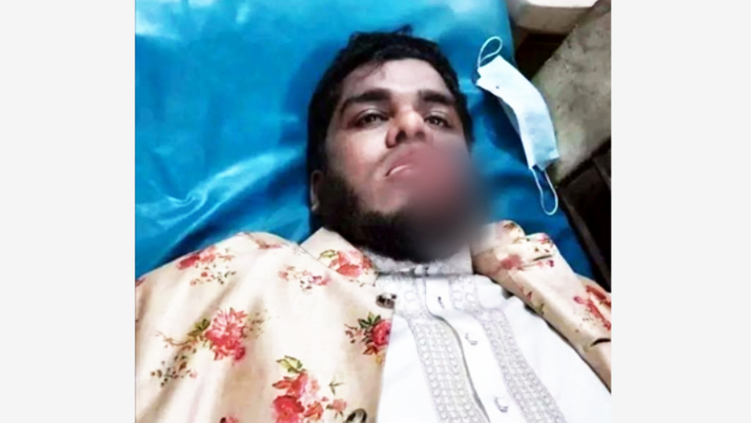 আহত ধর্মীয় বক্তা শরীফুল ইসলাম ভূঁইয়া