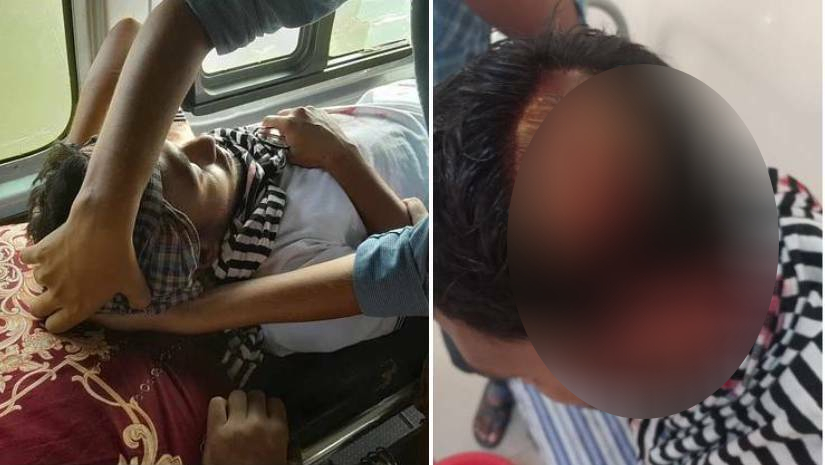 নোবিপ্রবিতে ছাত্রলীগের দুই পক্ষের মারামারিতে একজনের মাথা ফেটে যায়