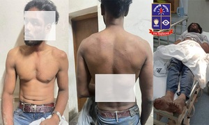 ঢাবি ছাত্রের নাকে-মুখে অনবরত স্টাম্পের আঘাত গ্যাংয়ের সদস্যদের