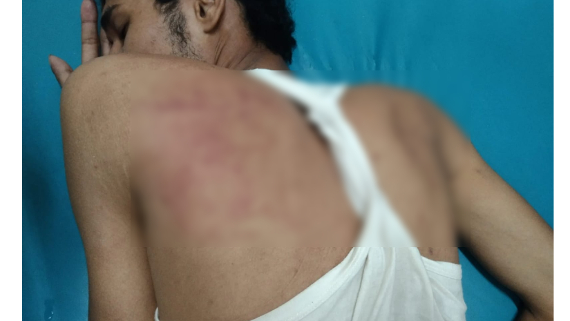 ছাত্রলীগের মারধরে আহত অধিকার পরিষদের সাংগঠনিক সম্পাদক নূর মোহাম্মদ সুমন