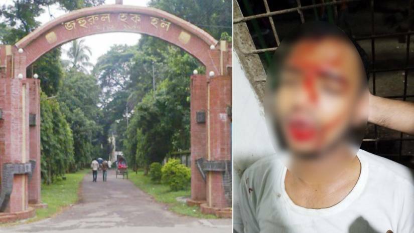 আহত শিক্ষার্থী দেলোয়ার হোসাইন