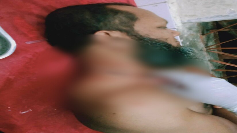 বিশ্ববিদ্যালয়ে চান্স না পাওয়ায় বাকবিতন্ডা, বাবাকে হত্যা করতে চাইল মেয়ে