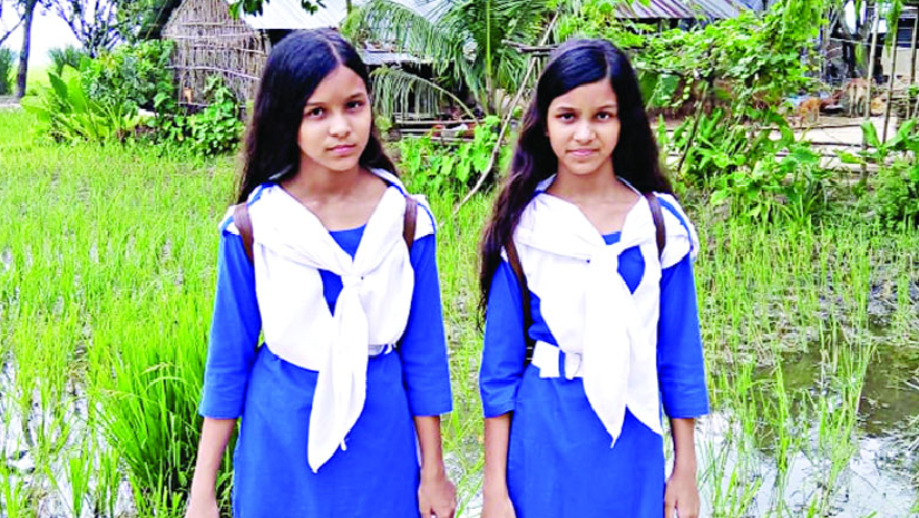 জোড়া লাগানো জনম দুই বোন মনি মুক্তা