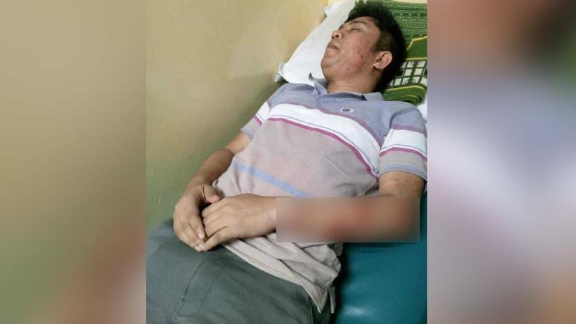 আহত ছাত্রদল কর্মী