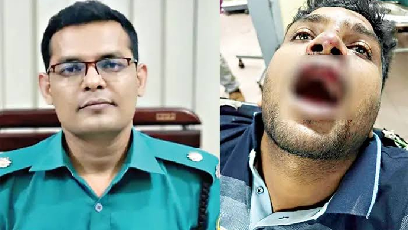 এডিসি হারুন ও আহত ছাত্রলীগ নেতা