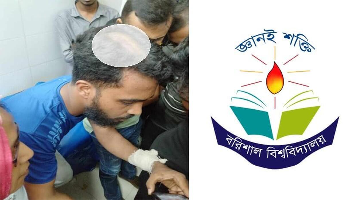 আহত শিক্ষার্থী রাফি শিকদার