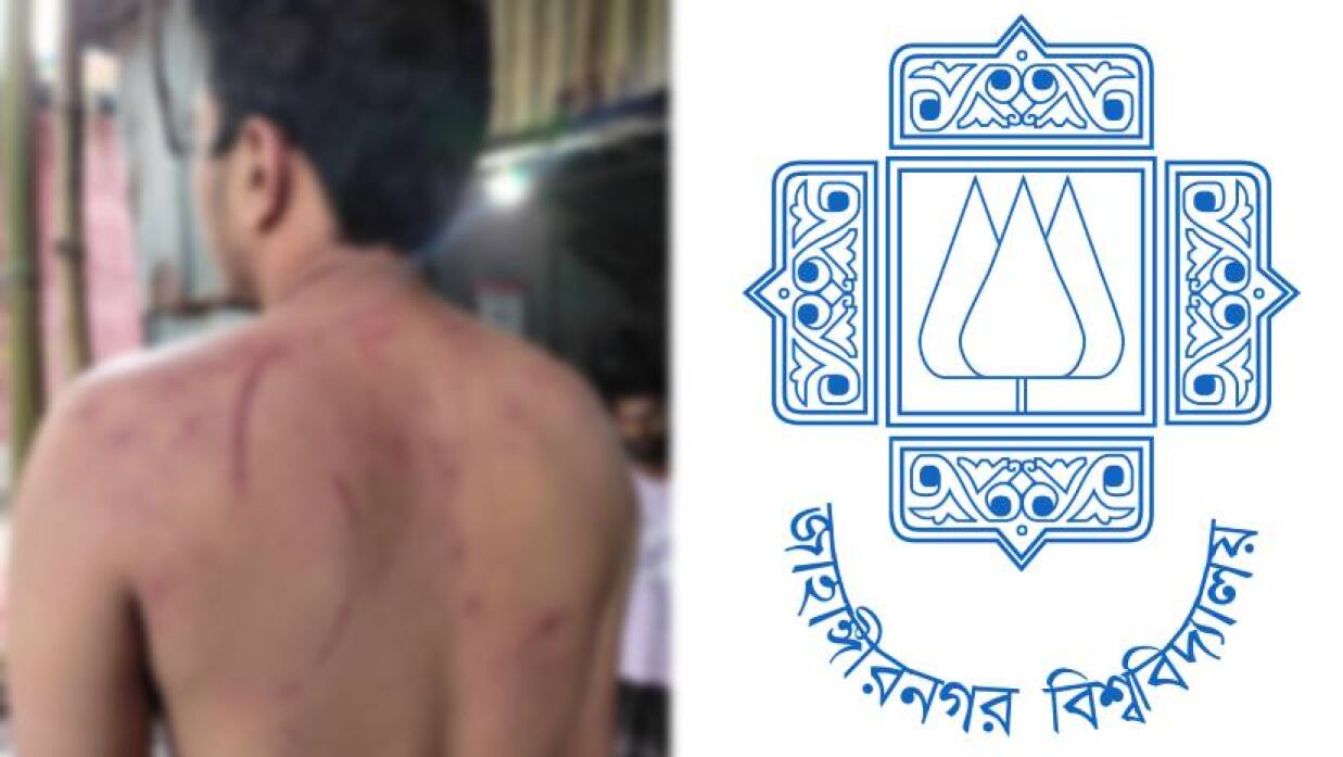 মারধরের শিকার সাবেক শিক্ষার্থী